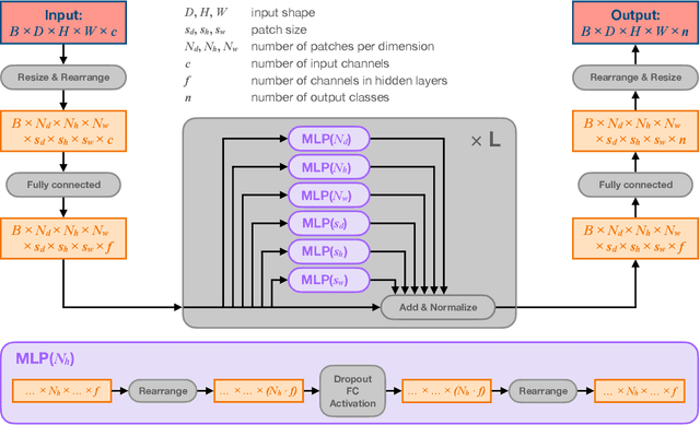 Figure 2 for Axial multi-layer perceptron architecture for automatic segmentation of choroid plexus in multiple sclerosis