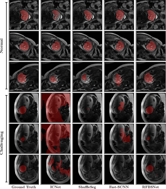 Figure 4 for Deep Learning Framework for Real-time Fetal Brain Segmentation in MRI
