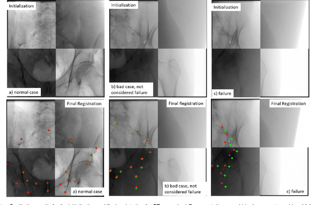 Figure 1 for Pose-dependent weights and Domain Randomization for fully automatic X-ray to CT Registration