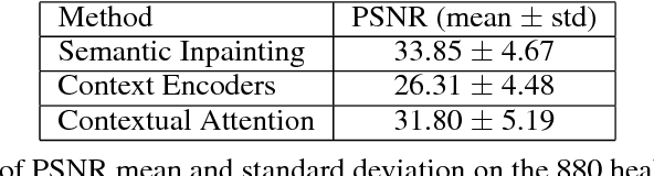 Figure 1 for Chest X-ray Inpainting with Deep Generative Models