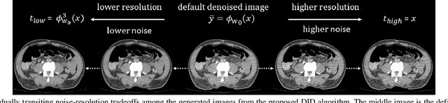 Figure 2 for Deep Interactive Denoiser for X-Ray Computed Tomography