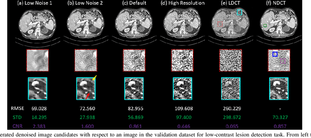 Figure 3 for Deep Interactive Denoiser  for X-Ray Computed Tomography