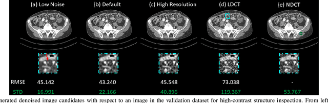 Figure 4 for Deep Interactive Denoiser for X-Ray Computed Tomography