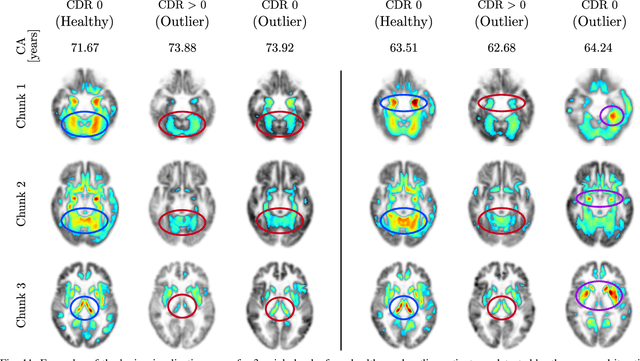 Figure 3 for Age-Net: An MRI-Based Iterative Framework for Biological Age Estimation