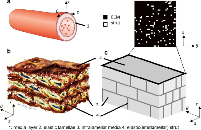 Figure 1 for Simulating progressive intramural damage leading to aortic dissection using an operator-regression neural network