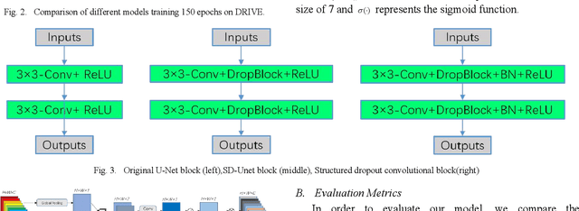Figure 2 for SA-UNet: Spatial Attention U-Net for Retinal Vessel Segmentation