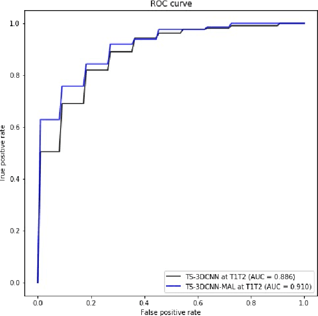 Figure 4 for Detection, growth quantification and malignancy prediction of pulmonary nodules using deep convolutional networks in follow-up CT scans
