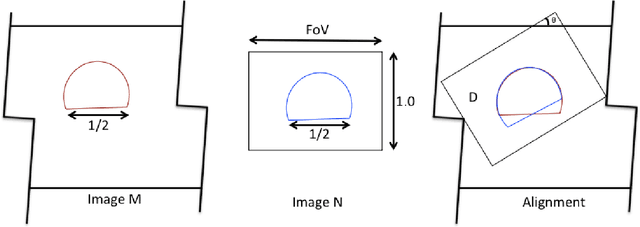Figure 1 for Validation of Tsallis Entropy In Inter-Modality Neuroimage Registration