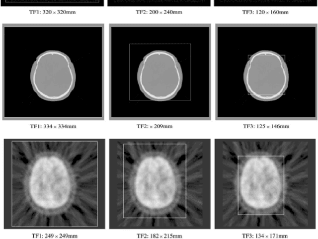 Figure 3 for Validation of Tsallis Entropy In Inter-Modality Neuroimage Registration