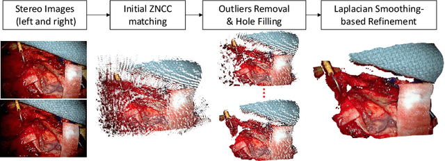 Figure 1 for Real-time Surface Deformation Recovery from Stereo Videos