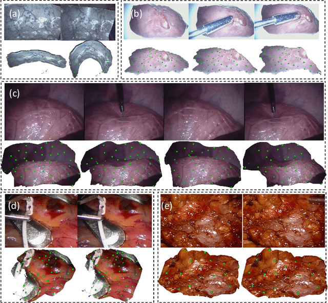 Figure 3 for Real-time Surface Deformation Recovery from Stereo Videos