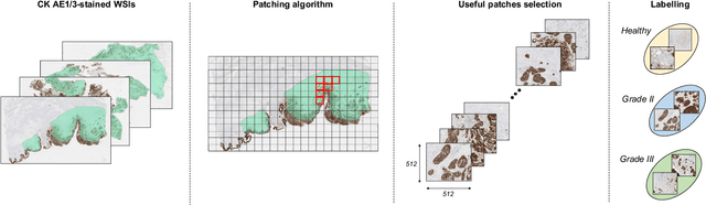 Figure 3 for A Novel Self-Learning Framework for Bladder Cancer Grading Using Histopathological Images