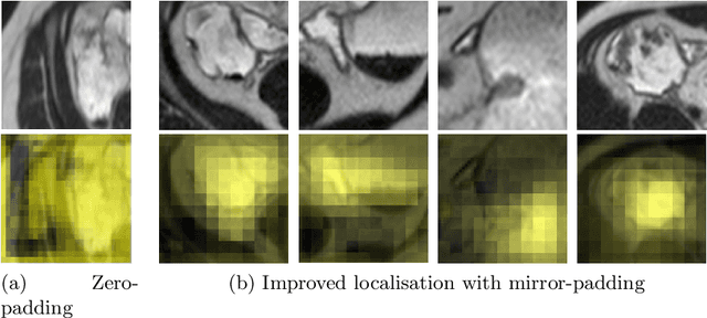 Figure 4 for Automatic Detection of Bowel Disease with Residual Networks