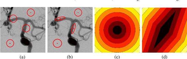 Figure 1 for Space-adaptive anisotropic bivariate Laplacian regularization for image restoration