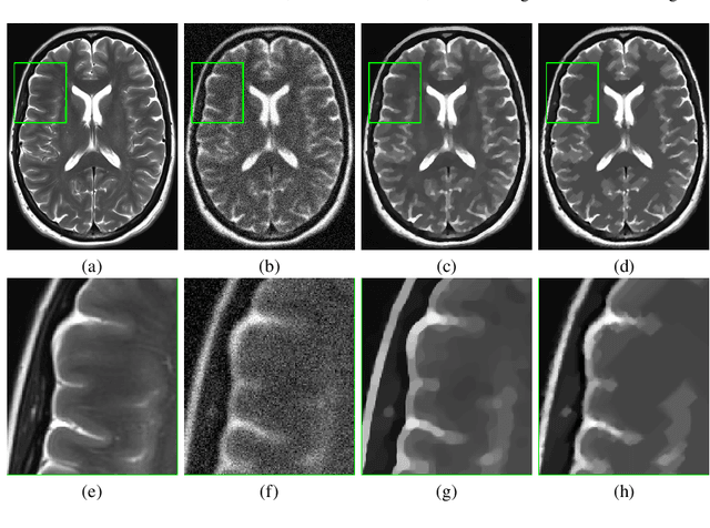 Figure 3 for Space-adaptive anisotropic bivariate Laplacian regularization for image restoration