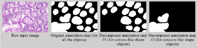 Figure 3 for Decompose-and-Integrate Learning for Multi-class Segmentation in Medical Images