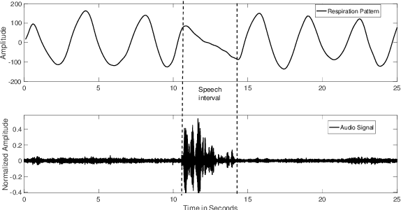 Figure 1 for RespVAD: Voice Activity Detection via Video-Extracted Respiration Patterns