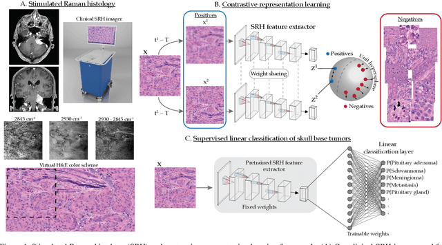 Figure 1 for Contrastive Representation Learning for Rapid Intraoperative Diagnosis of Skull Base Tumors Imaged Using Stimulated Raman Histology