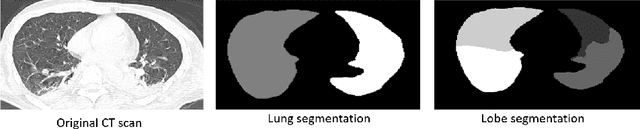 Figure 3 for An Explainable AI System for Automated COVID-19 Assessment and Lesion Categorization from CT-scans