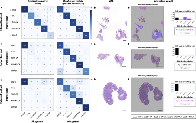 Figure 4 for A hybrid 2-stage vision transformer for AI-assisted 5 class pathologic diagnosis of gastric endoscopic biopsies