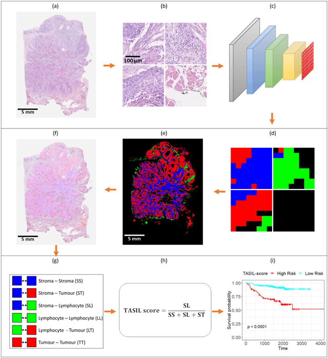 Figure 1 for A digital score of tumour-associated stroma infiltrating lymphocytes predicts survival in head and neck squamous cell carcinoma