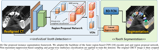 Figure 4 for Pose-Aware Instance Segmentation Framework from Cone Beam CT Images for Tooth Segmentation