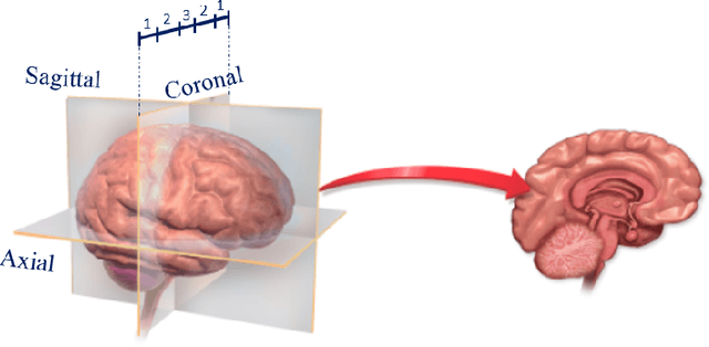 Figure 2 for Accurate brain extraction using Active Shape Model and Convolutional Neural Networks