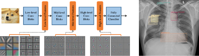 Figure 1 for Rethink Transfer Learning in Medical Image Classification