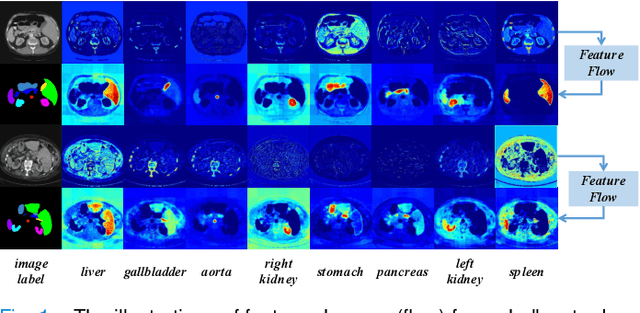 Figure 1 for Graph Flow: Cross-layer Graph Flow Distillation for Dual Efficient Medical Image Segmentation