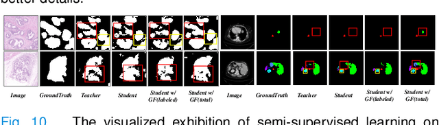 Figure 2 for Graph Flow: Cross-layer Graph Flow Distillation for Dual Efficient Medical Image Segmentation