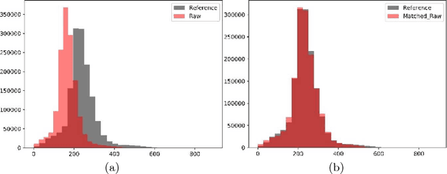 Figure 3 for Automatic Segmentation and Overall Survival Prediction in Gliomas using Fully Convolutional Neural Network and Texture Analysis