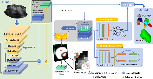 Figure 3 for Contrastive Rendering for Ultrasound Image Segmentation