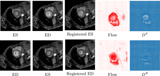 Figure 3 for A training-free recursive multiresolution framework for diffeomorphic deformable image registration