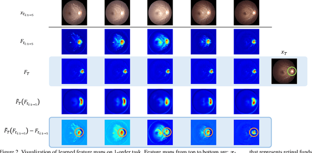 Figure 4 for Disease Forecast via Progression Learning