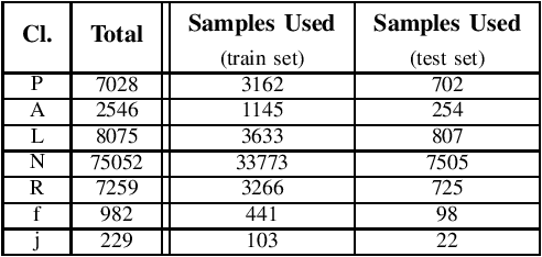 Figure 4 for Arrhythmia Classification using CGAN-augmented ECG Signals
