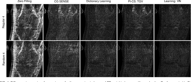 Figure 4 for Learning a Variational Network for Reconstruction of Accelerated MRI Data