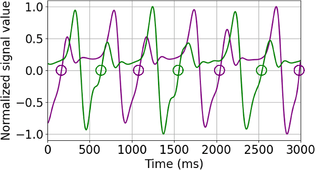 Figure 2 for Gait-based Frailty Assessment using Image Representation of IMU Signals and Deep CNN