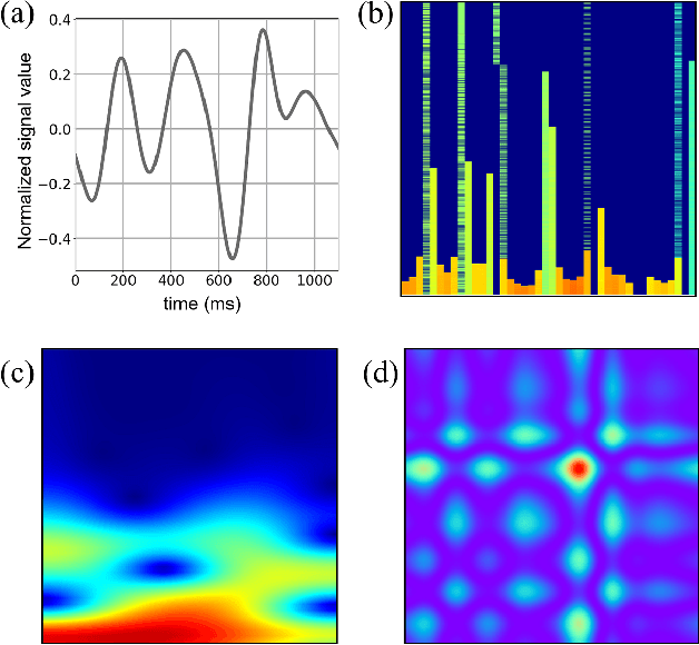 Figure 3 for Gait-based Frailty Assessment using Image Representation of IMU Signals and Deep CNN