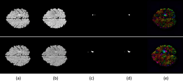 Figure 3 for Spatio-temporal Learning from Longitudinal Data for Multiple Sclerosis Lesion Segmentation