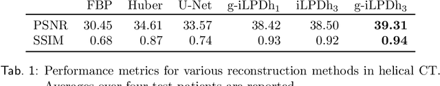 Figure 2 for 3D helical CT reconstruction with memory efficient invertible Learned Primal-Dual method