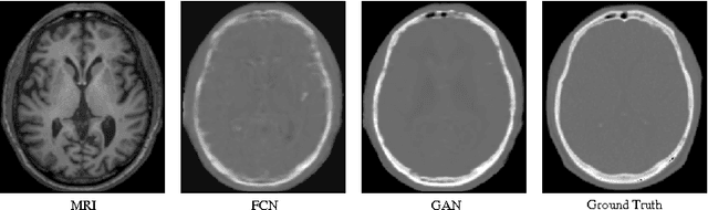 Figure 4 for Medical Image Synthesis with Context-Aware Generative Adversarial Networks