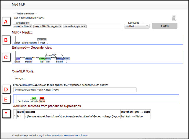 Figure 3 for A Case Study on Pros and Cons of Regular Expression Detection and Dependency Parsing for Negation Extraction from German Medical Documents. Technical Report