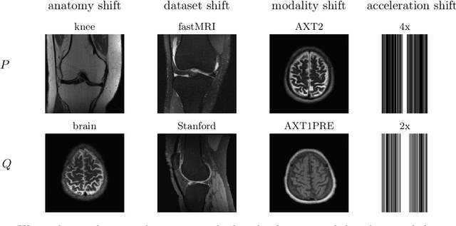 Figure 1 for Test-Time Training Can Close the Natural Distribution Shift Performance Gap in Deep Learning Based Compressed Sensing