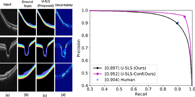 Figure 4 for Uncertainty guided semi-supervised segmentation of retinal layers in OCT images