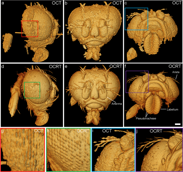 Figure 4 for Computational 3D microscopy with optical coherence refraction tomography