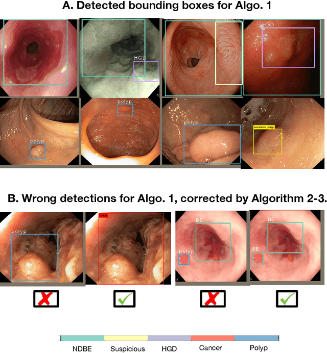 Figure 2 for Endoscopy disease detection challenge 2020