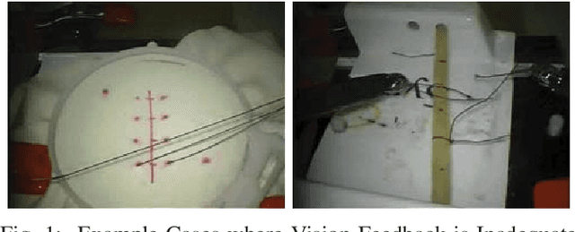 Figure 1 for Context-aware Monitoring in Robotic Surgery