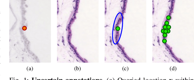 Figure 1 for Uncertainty-Aware Annotation Protocol to Evaluate Deformable Registration Algorithms