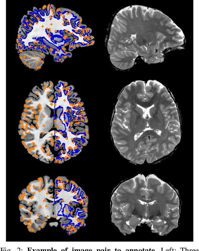 Figure 3 for Uncertainty-Aware Annotation Protocol to Evaluate Deformable Registration Algorithms