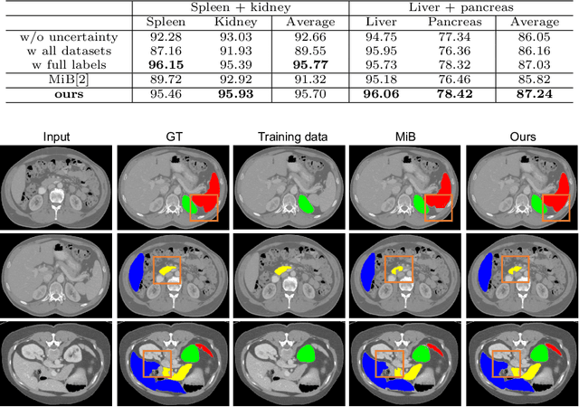 Figure 4 for Uncertainty-aware Incremental Learning for Multi-organ Segmentation